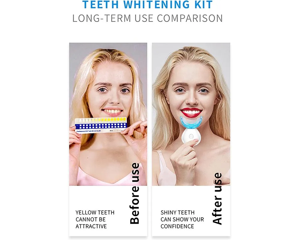 Teeth whitening kits Dental Whitener Kit